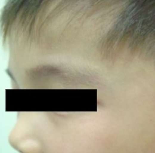 Before/After Image